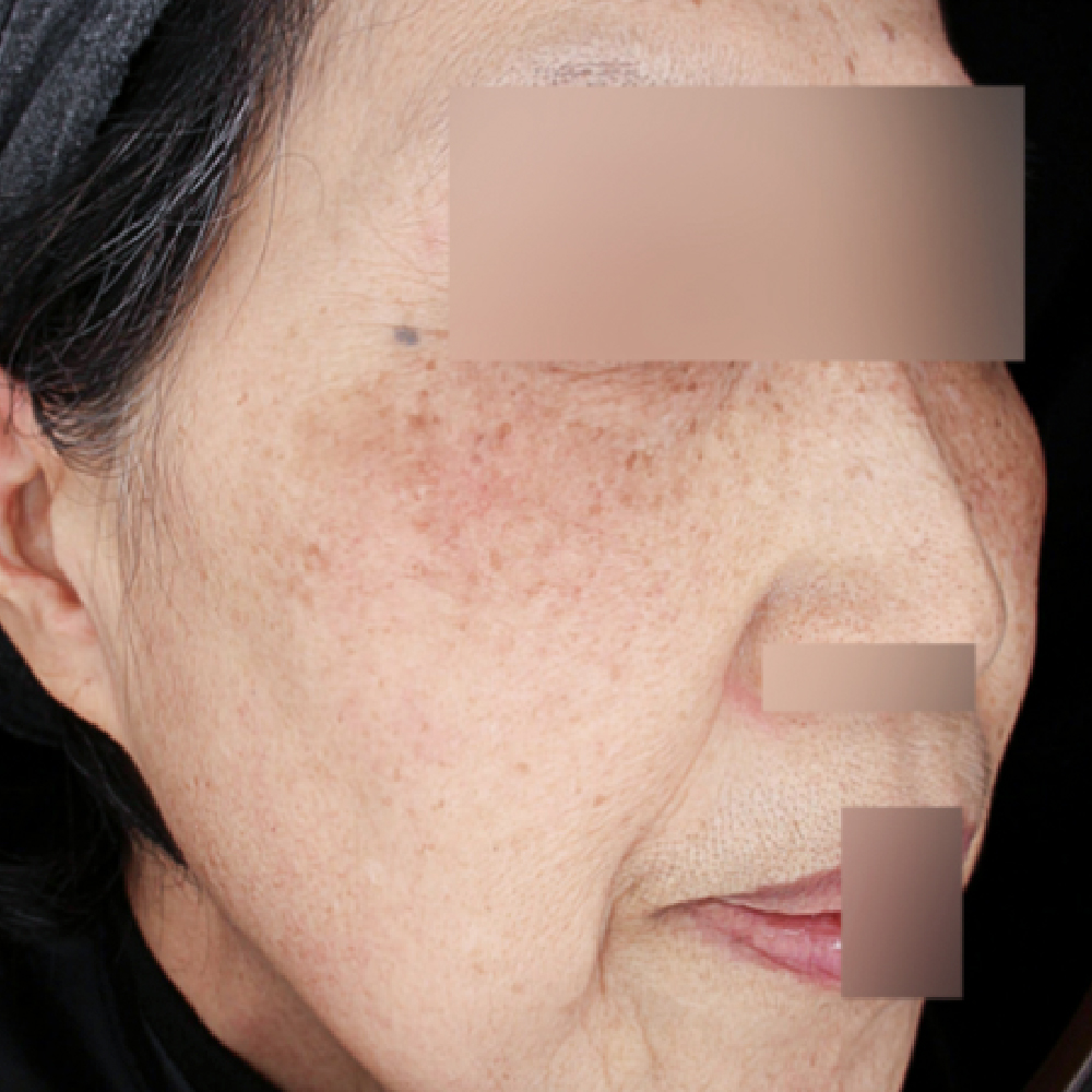 首頁PIC_案例1 after 首頁PIC_案例1 after