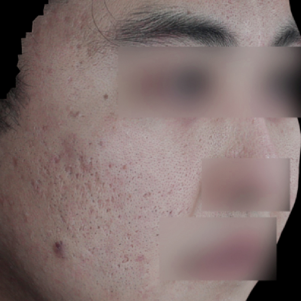 首頁PIC_案例1 before 首頁PIC_案例1 before