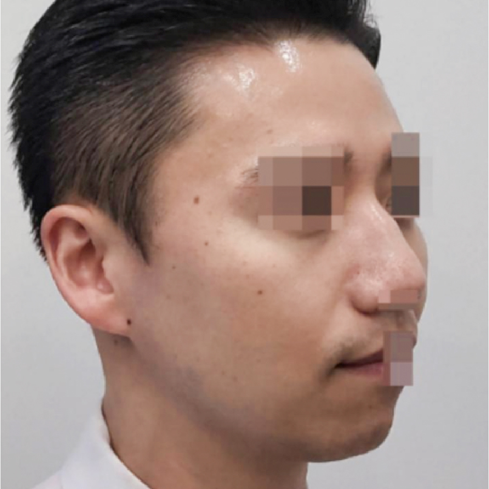 首頁PIC_案例2 after 首頁PIC_案例2 after