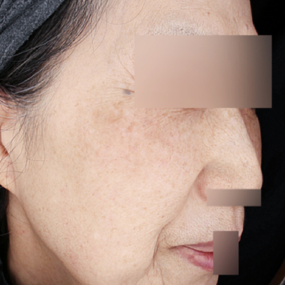 首頁PIC_案例2 before