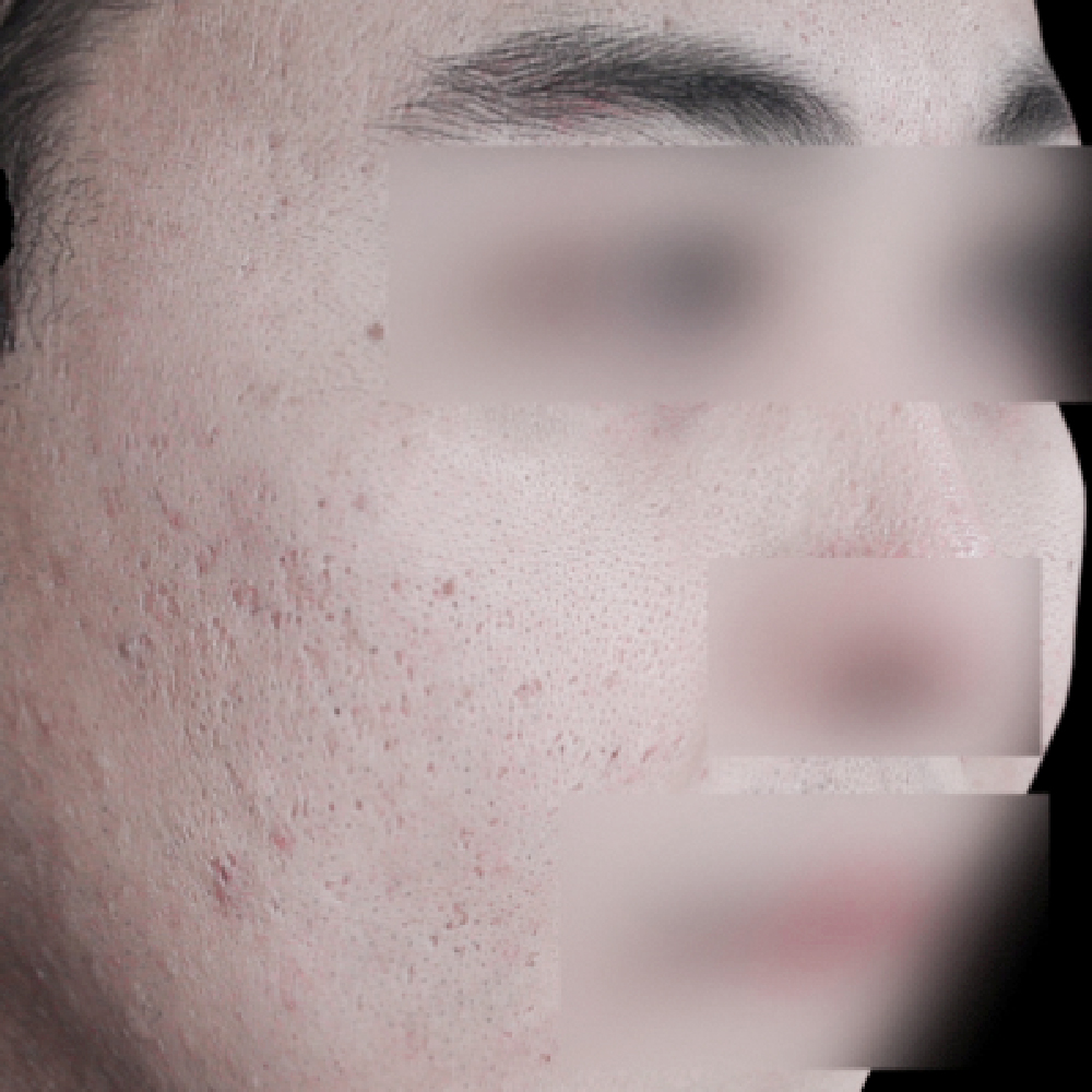 首頁PIC_案例3 after