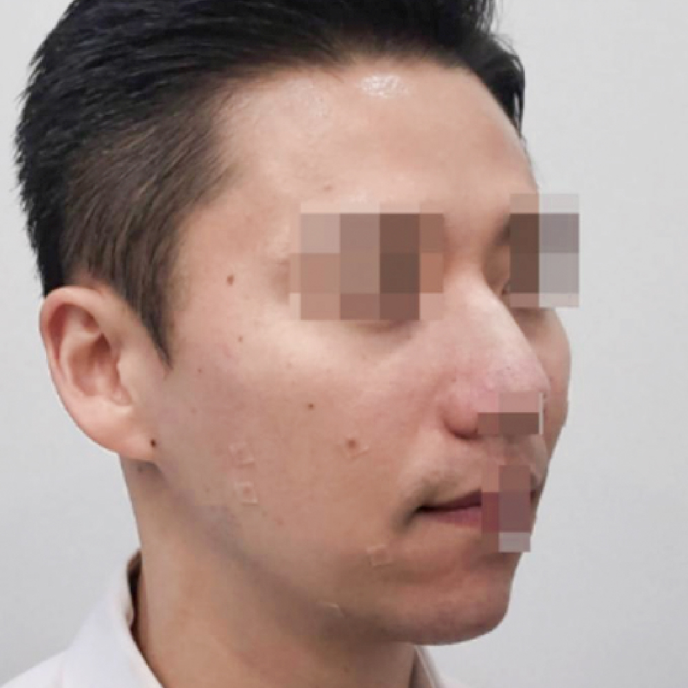 首頁PIC_案例3 before