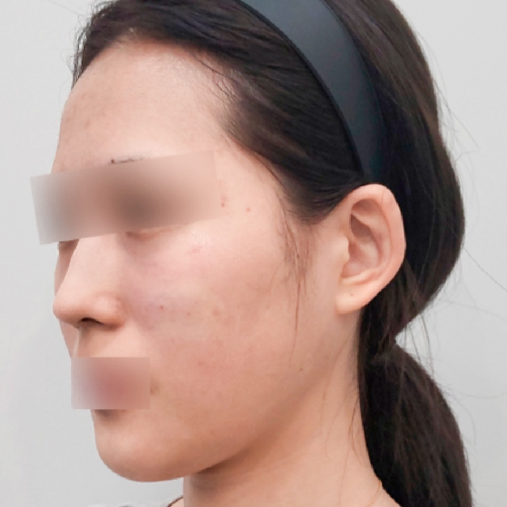 首頁PIC_案例4 after