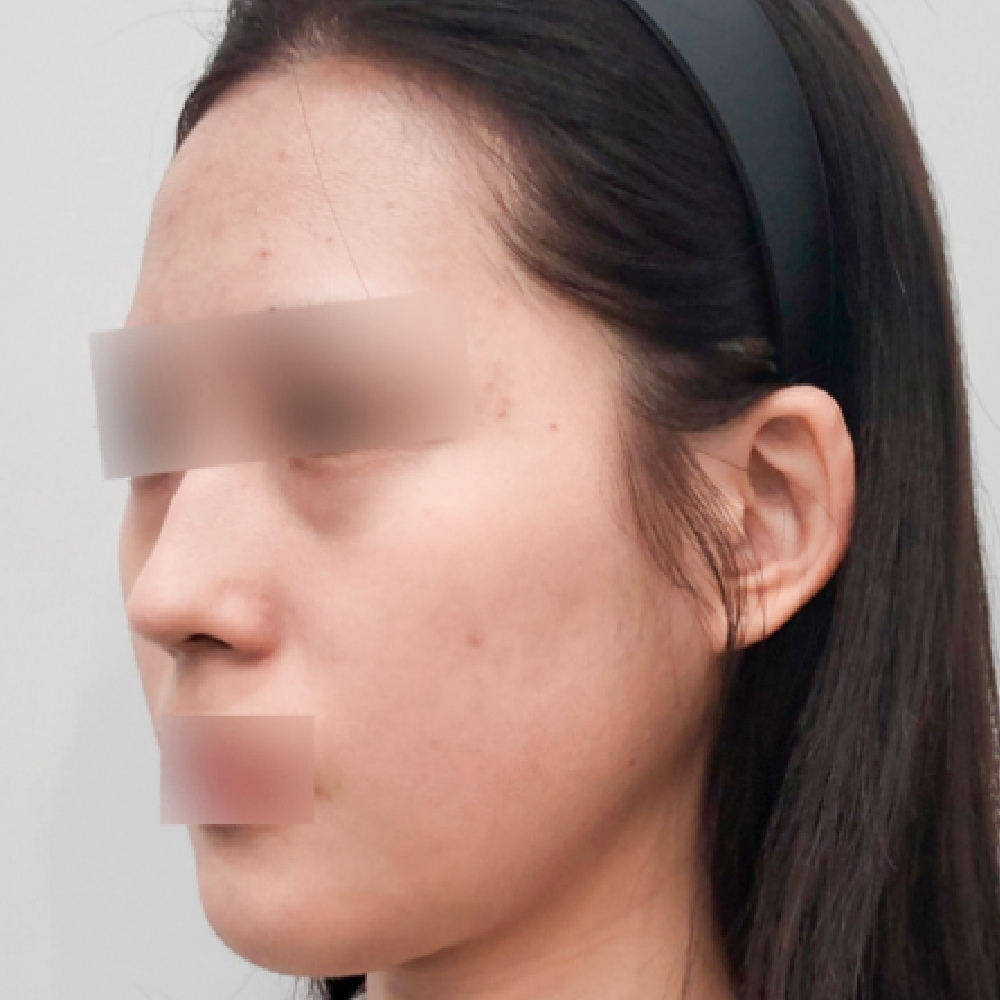 首頁PIC_案例4 before 首頁PIC_案例4 before